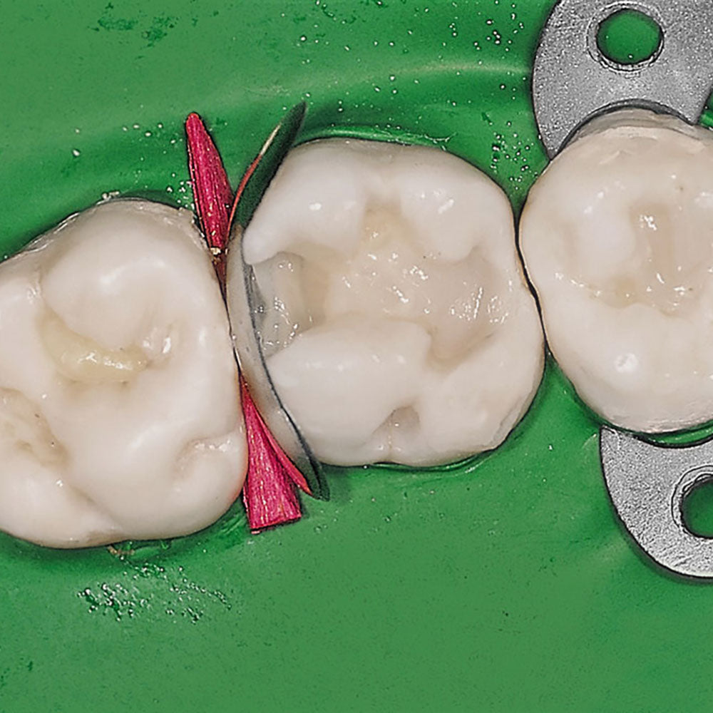 TDV Cales anatomiques