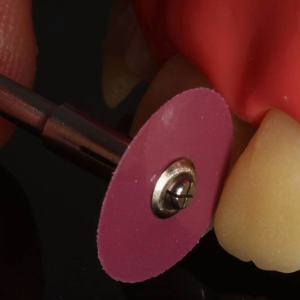 TDV Praxis Disques de finition et de polissage pour composites