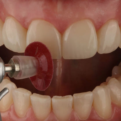 TDV Superfix